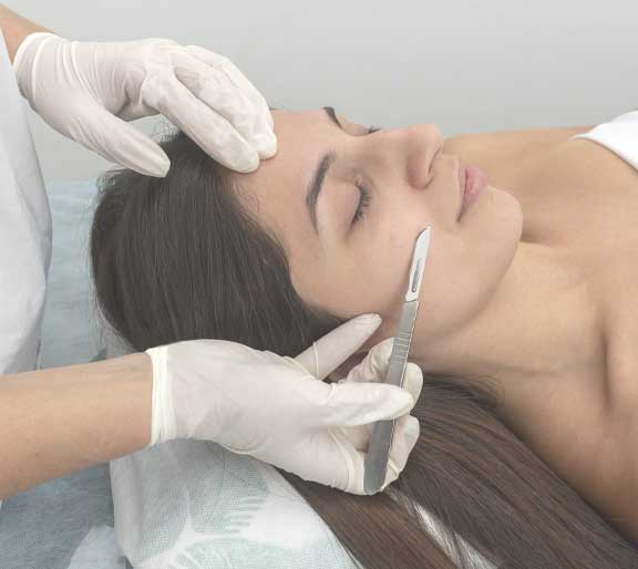 dermaplaning-west-palm-beach